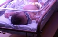 Jaundice in Newborns